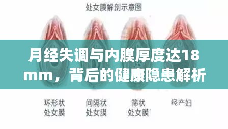 月经失调与内膜厚度达18mm，背后的健康隐患解析