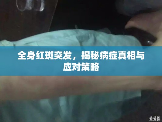 全身红斑突发，揭秘病症真相与应对策略
