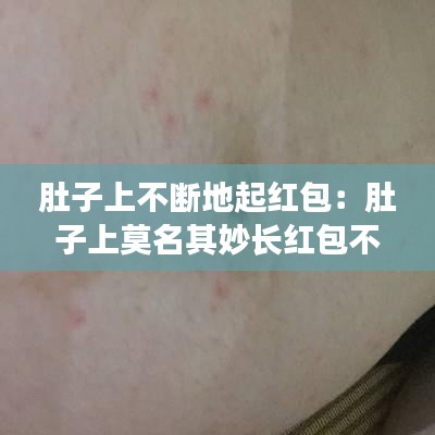 肚子上不断地起红包：肚子上莫名其妙长红包不痛不痒 