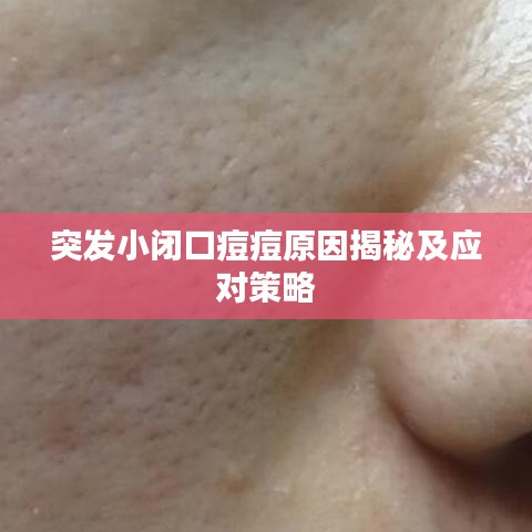 突发小闭口痘痘原因揭秘及应对策略
