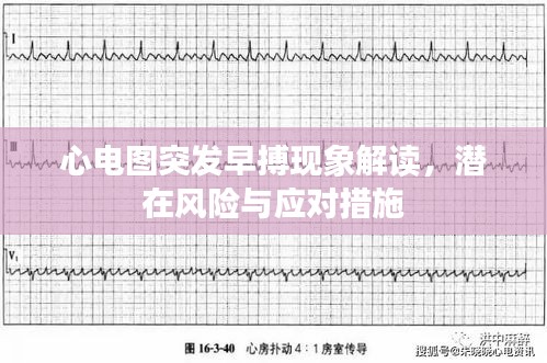 心电图突发早搏现象解读，潜在风险与应对措施