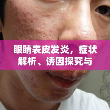 眼睛表皮发炎，症状解析、诱因探究与应对之策