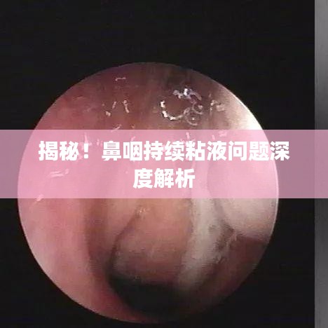 揭秘！鼻咽持续粘液问题深度解析