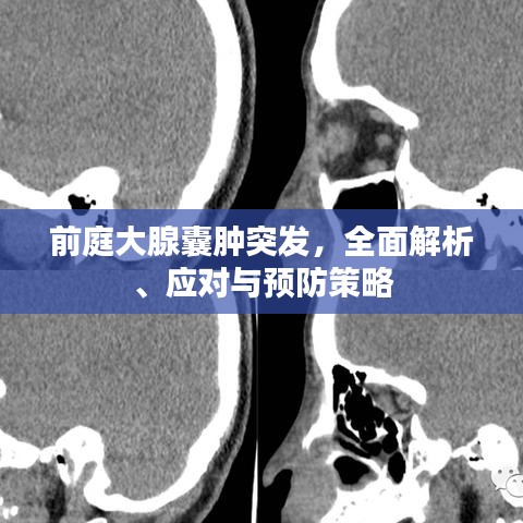 前庭大腺囊肿突发，全面解析、应对与预防策略